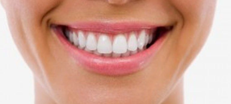 cuidar implantes