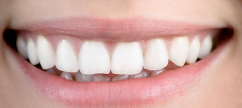 gingivitis