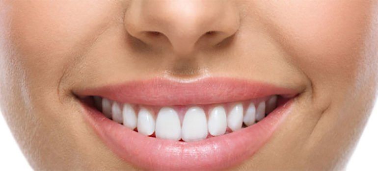 Odontología Estética