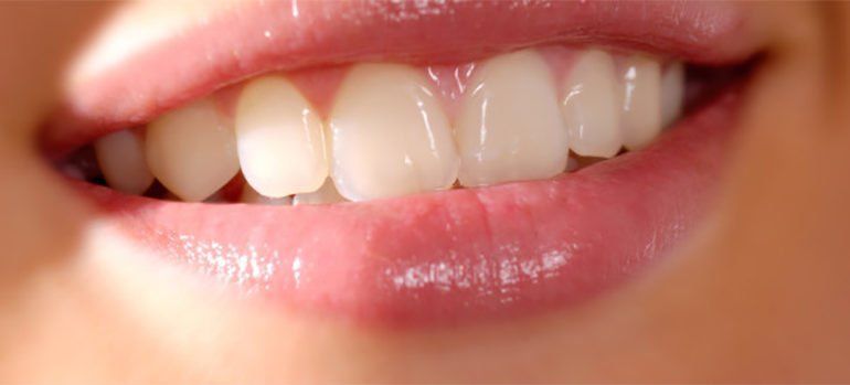 protesis dental